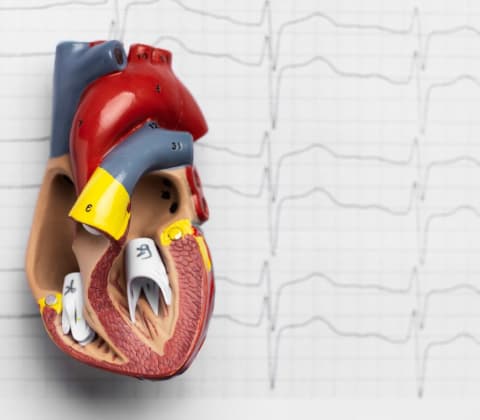 Preventative Cardiology Overview